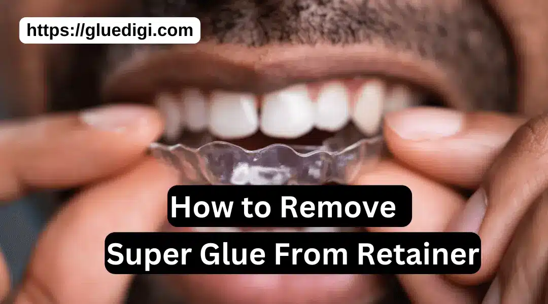 How to Remove Super Glue From Retainer