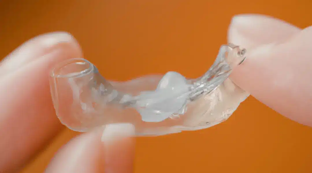 How To Remove Super Glue From Retainer?