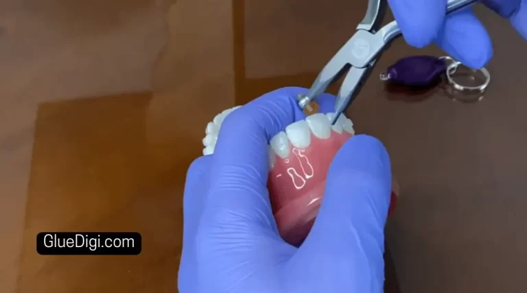 How to Remove Leftover Glue from Braces