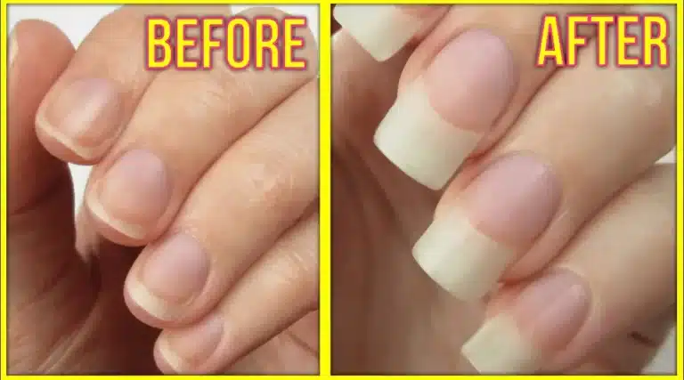 Unlock the Secrets: How to Accelerate Nail Growth Naturally