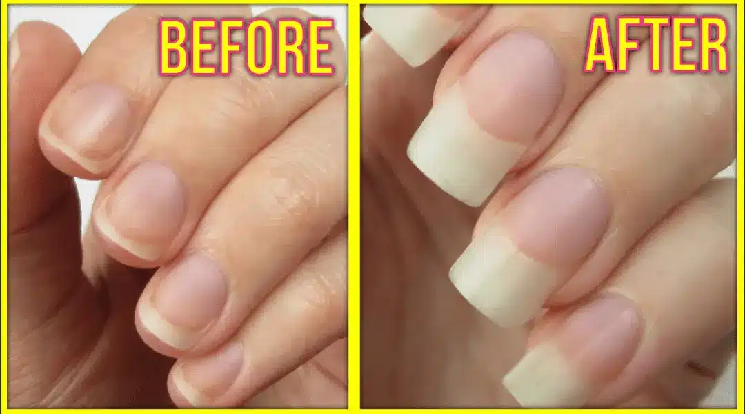 How to Accelerate Nail Growth Naturally